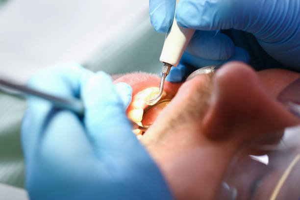 Best Emergency Orthodontic Repairs in Fairfield, OH